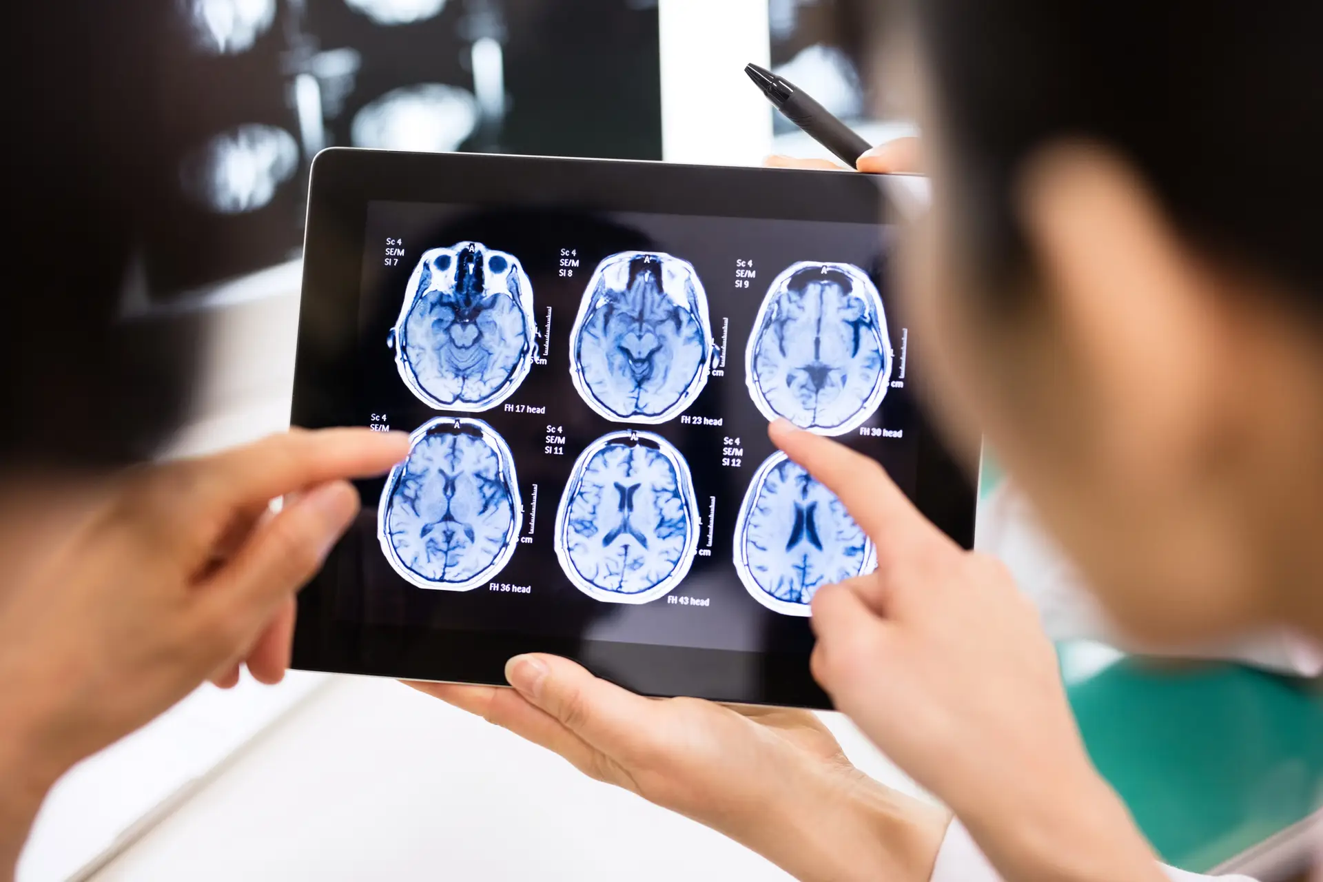 Cientistas de Coimbra estudam novas formas de tratar o traumatismo cranioencefálico