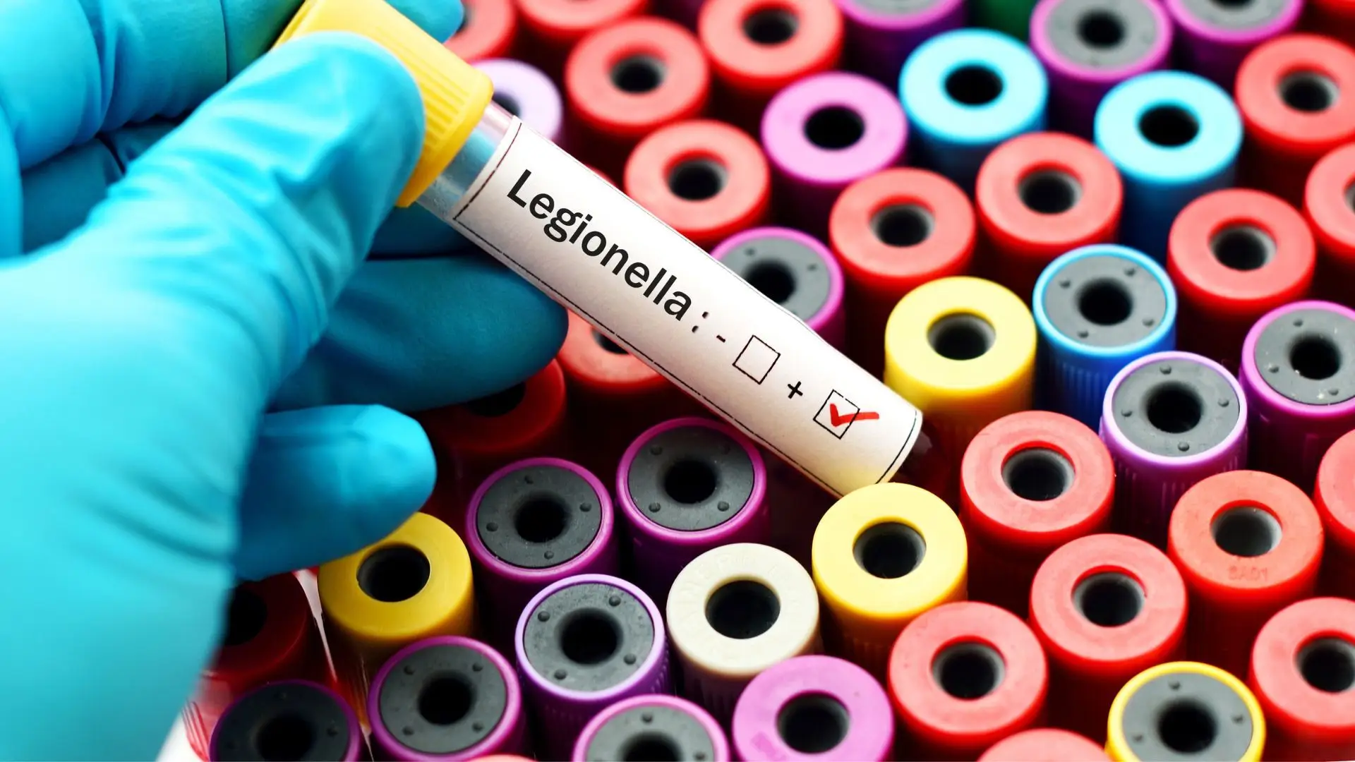 Legionella obriga a fechar pavilhão de escola secundária em Reguengos de Monsaraz