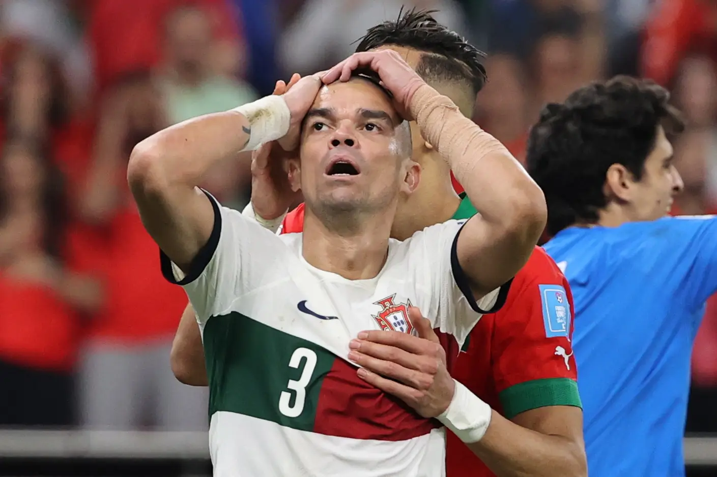 Pepe fratura o cúbito do braço esquerdo