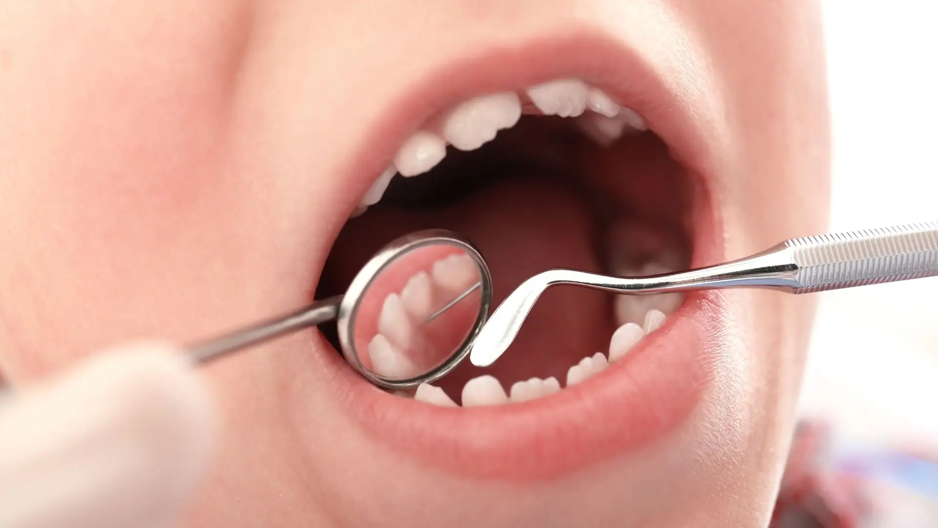 Criança no dentista - Imagem ilustrativa.