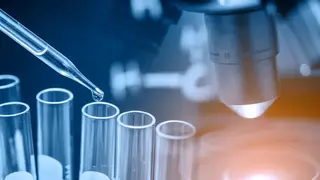 Investigadores da FMUP relacionam cancro da próstata com microbiota genital e urinária