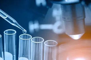 Investigadores da FMUP relacionam cancro da próstata com microbiota genital e urinária