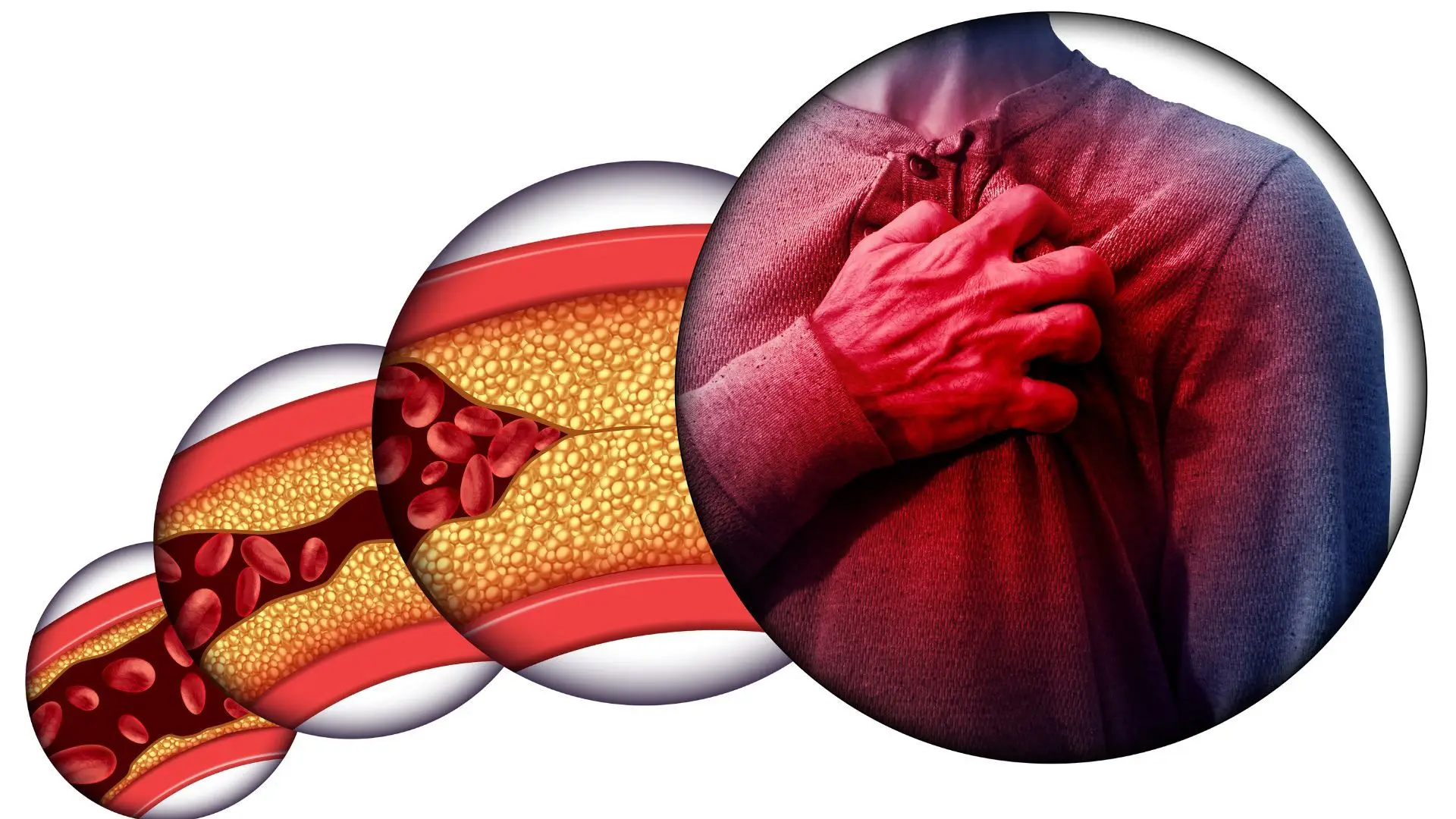 The University of Avero creates a food supplement to reduce cholesterol