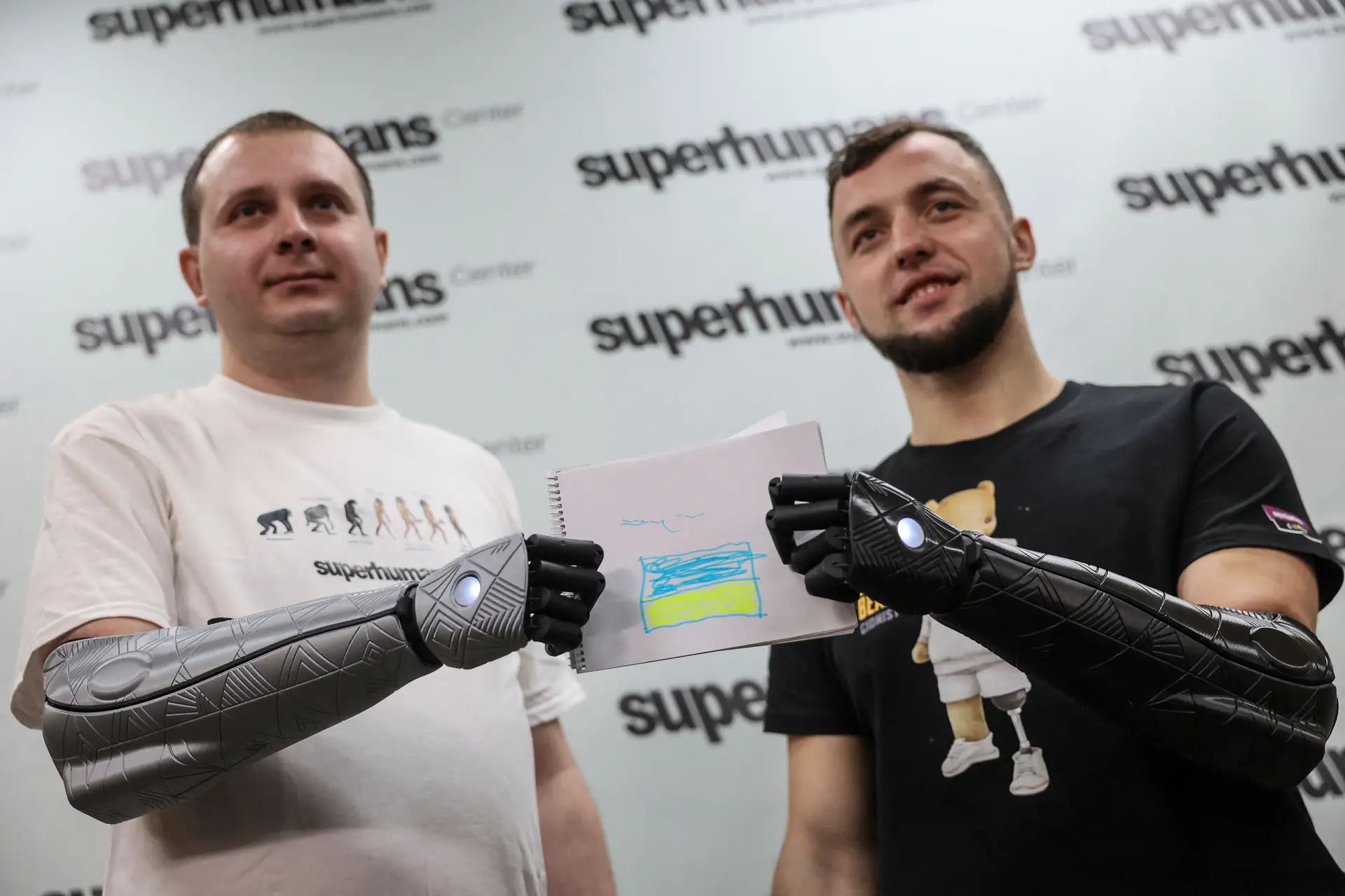 "Hero Arm": empresa britânica testa próteses em feridos de guerra na Ucrânia