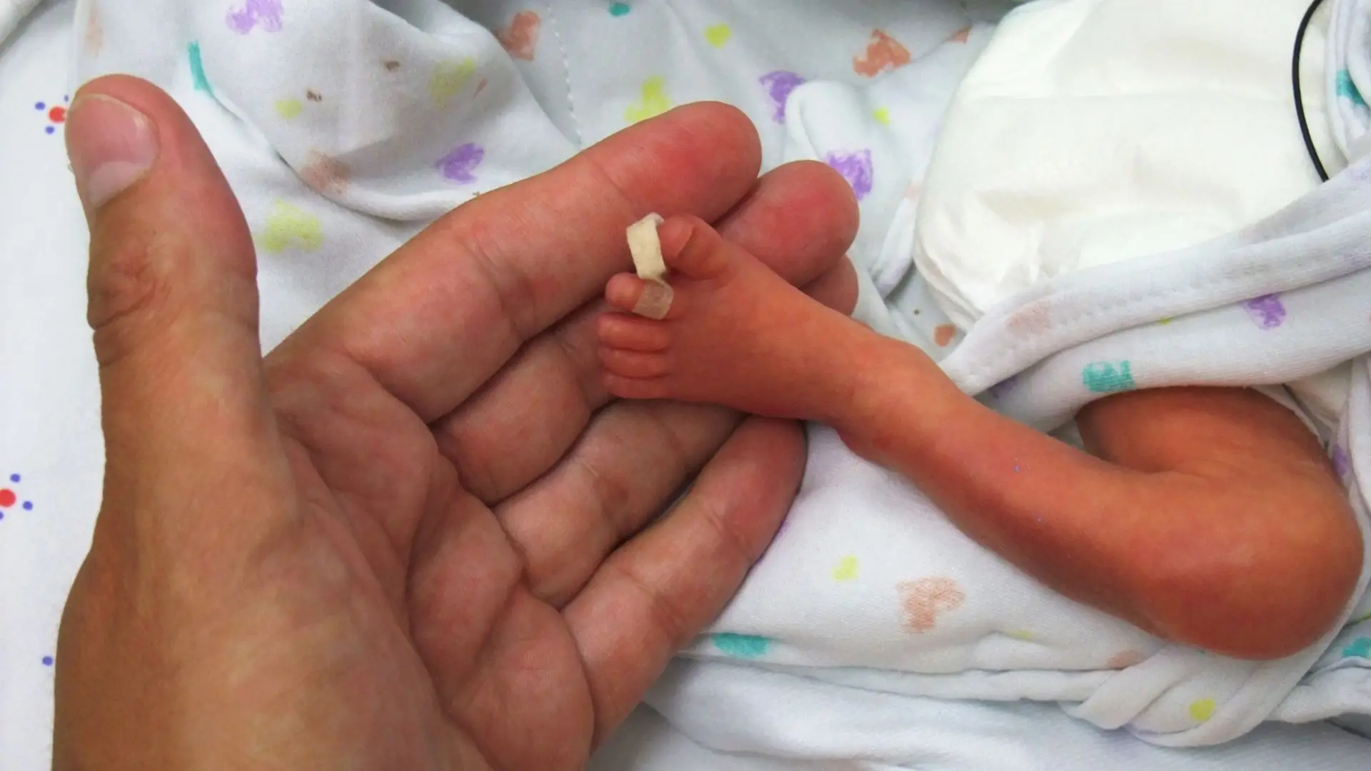 É possível evitar a morte de 1 milhão de bebés em países pobres? Especialistas sugerem 10 medidas