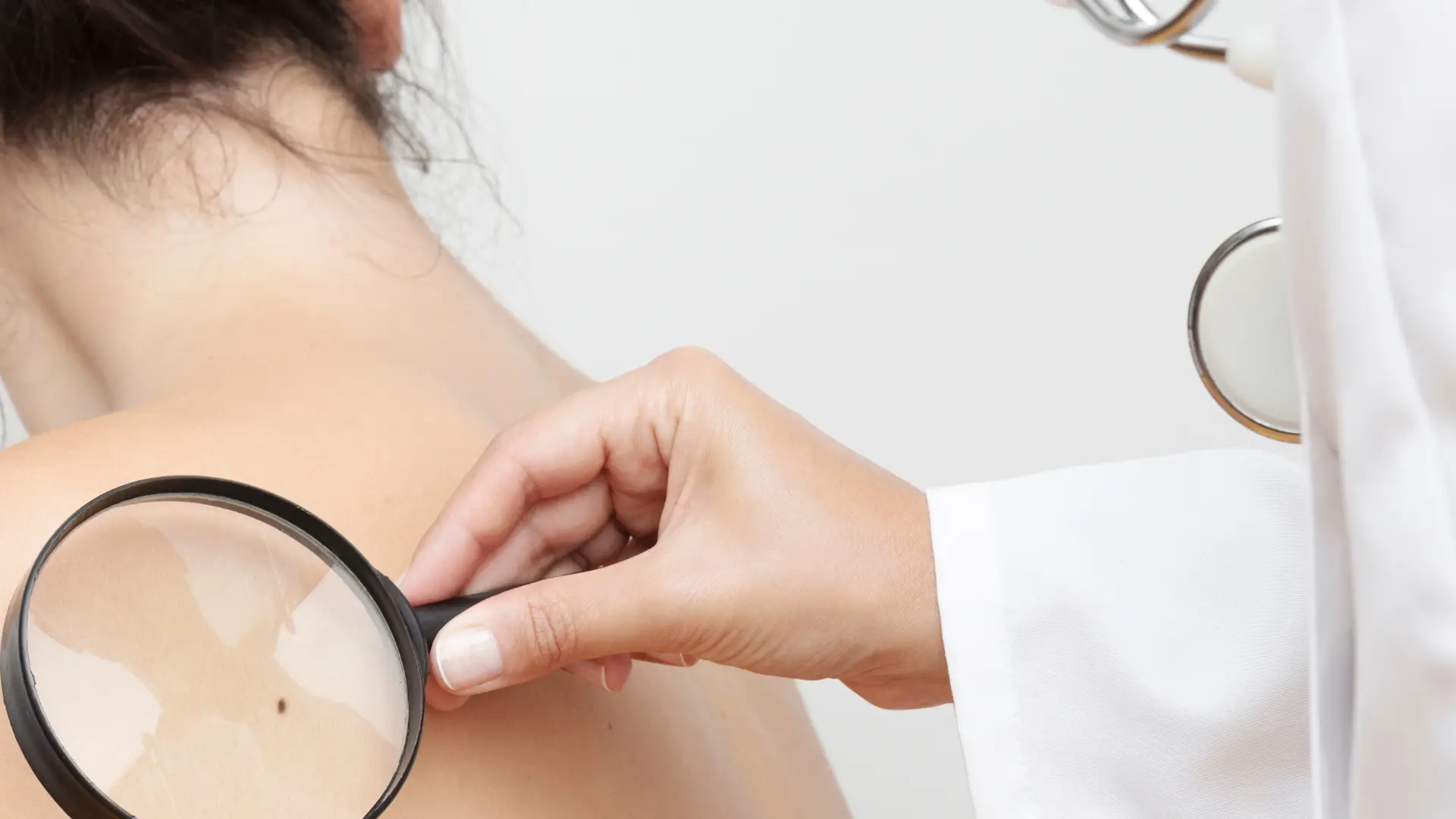 Homens e mulheres desenvolvem cancro da pele em zonas diferentes do corpo, revela estudo