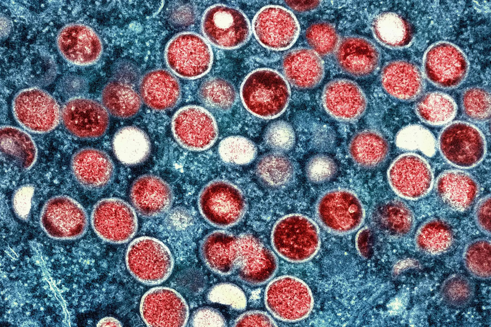 Mpox em África: OMS prolonga por mais um ano as recomendações
 #ÚltimasNotícias #Portugal