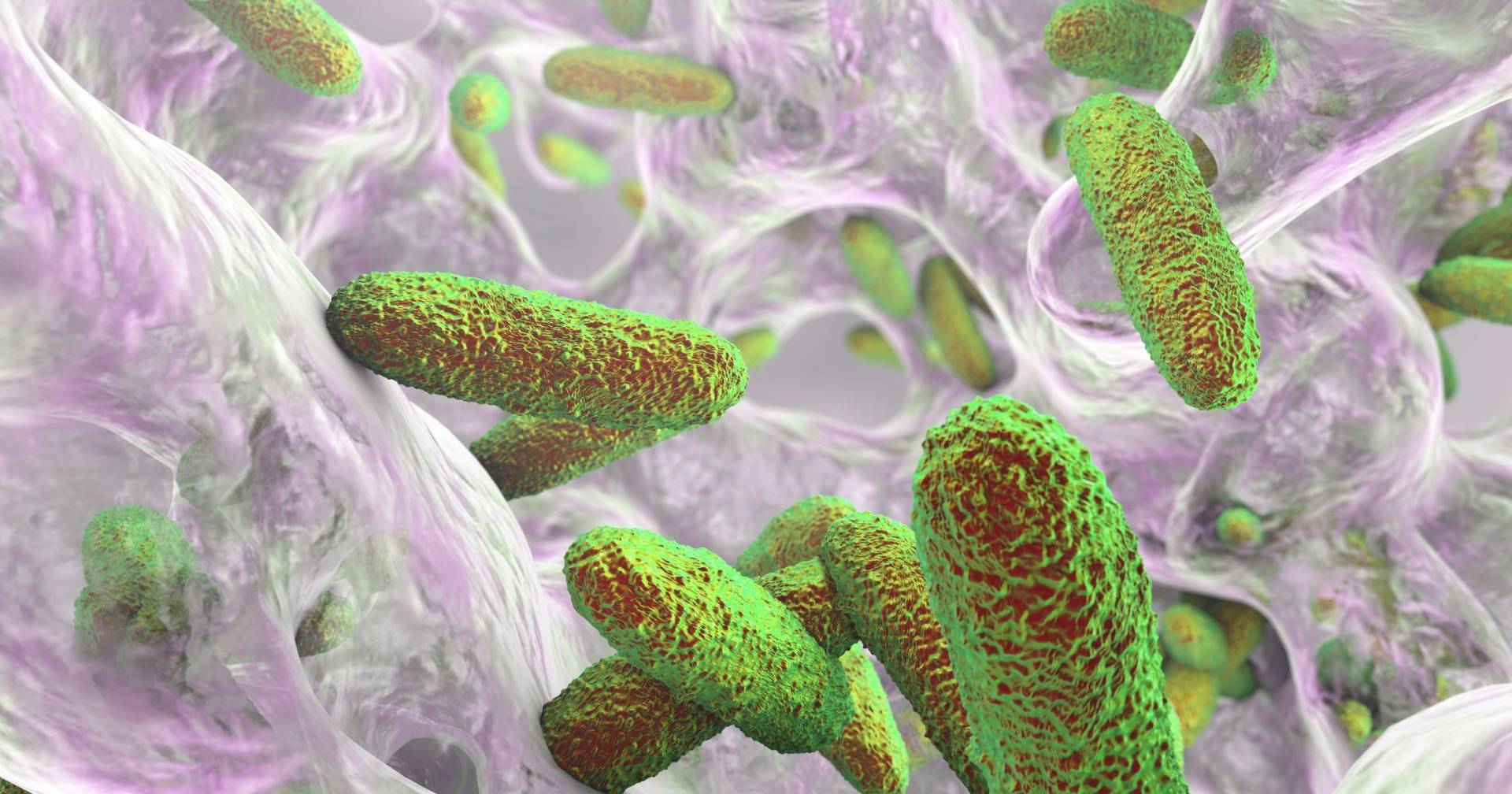 Klebsiella, conheça a bactéria multirresistente que afeta 11 bebés no ...