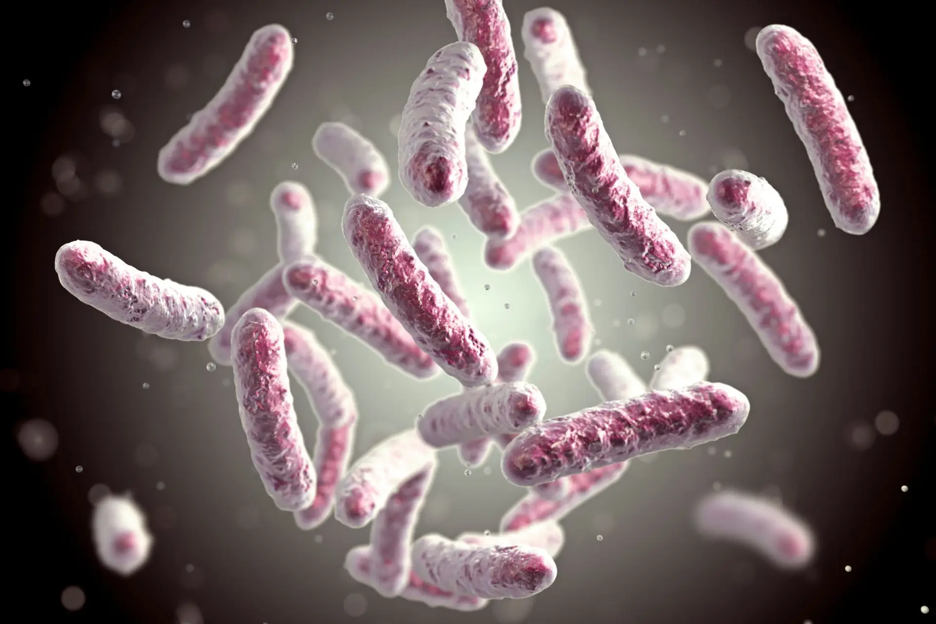 legionella