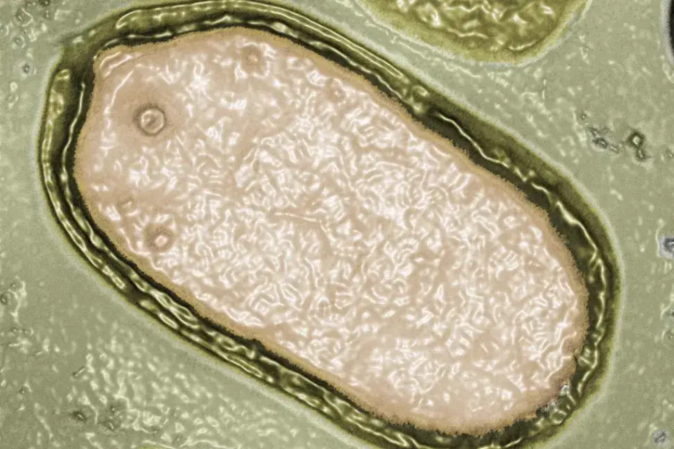 Vírus 'zombies' congelados na Sibéria podem causar novas pandemias