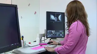 DGS pondera antecipar idade para rastreio ao cancro da mama