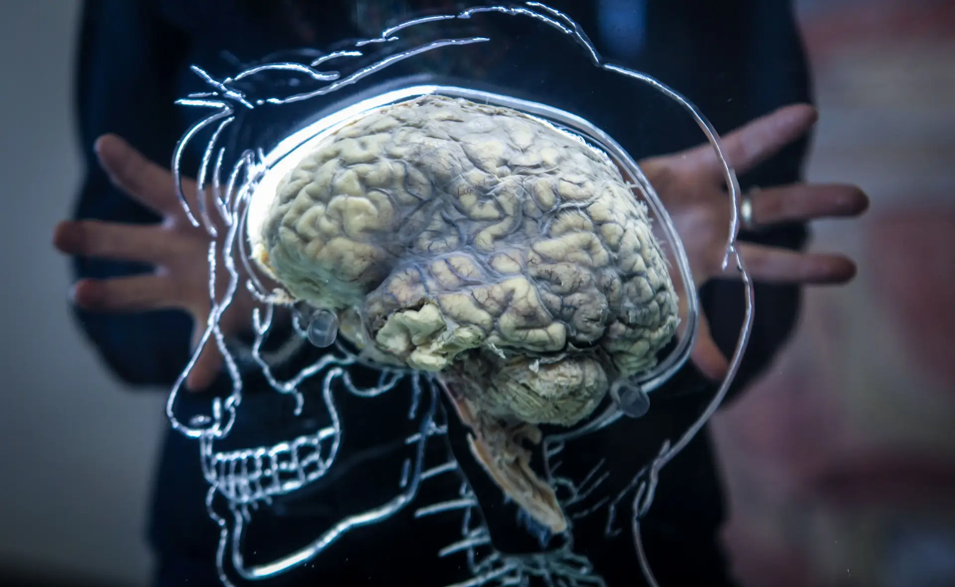 Projeto português sobre demência é um dos finalistas de prémio milionário