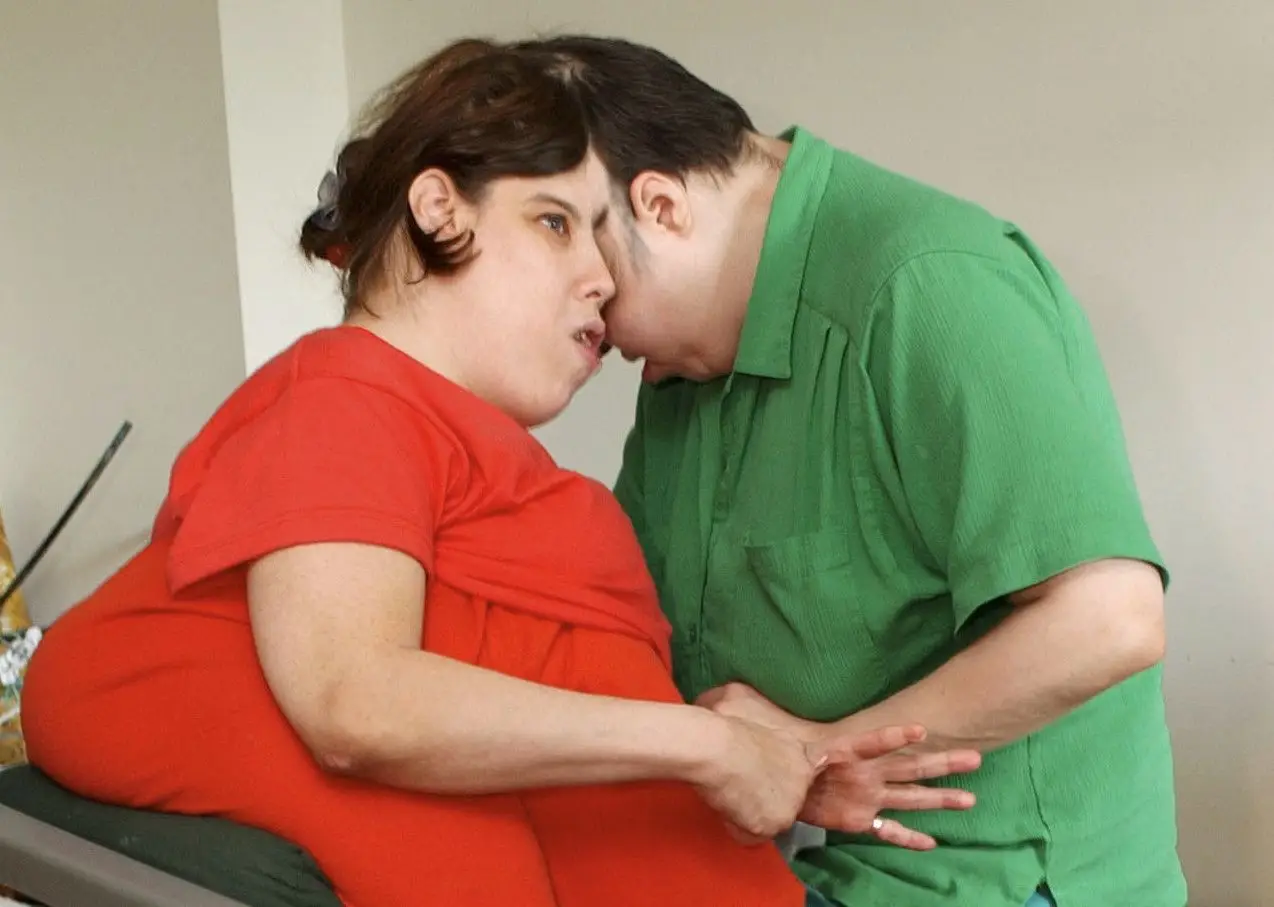 Morreram os gémeos siameses mais velhos do mundo
