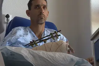 Apenas com tendão preso, hospital Santa Maria salva mão amputada