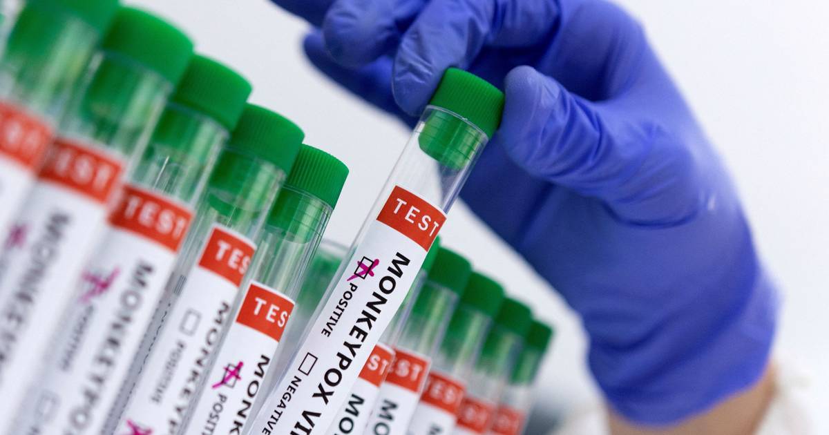 Desde 2025 que está a aumentar transmissão do vírus mpox em Portugal