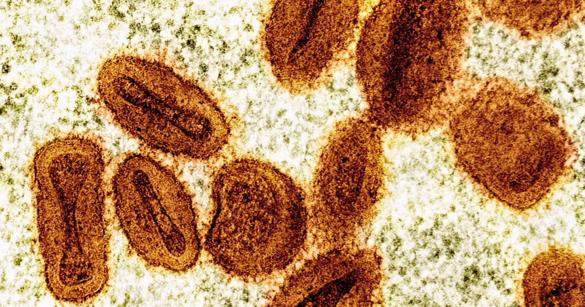 Especialistas alertam que o mundo está menos preparado para uma nova pandemia