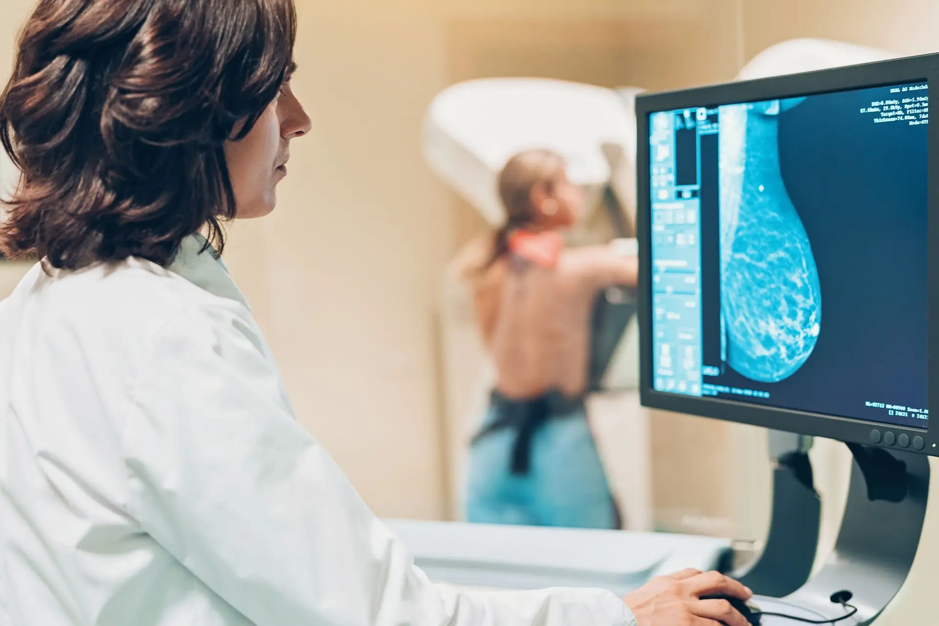 Cancro da mama: quatro mulheres diagnosticadas "a cada minuto" em todo o mundo, casos e mortes deverão aumentar nos próximos 25 anos