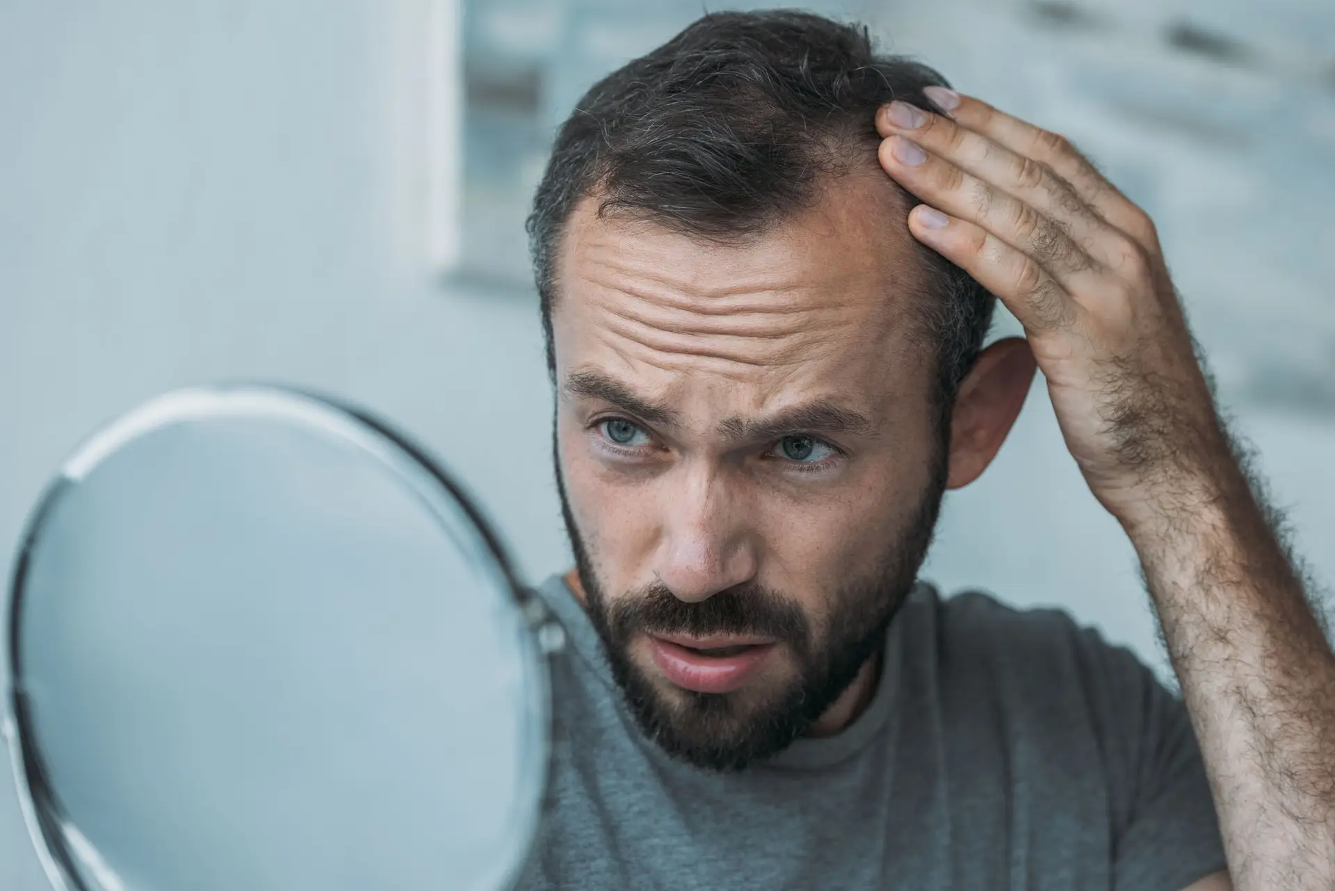 ¿La solución para la calvicie? Los científicos revelan la proteína que puede prevenir la pérdida de cabello