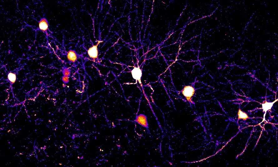 Os neurónios e as suas extensões ramificadas, conhecidas como dendritos, no córtex cerebral do ratinho de laboratório.
