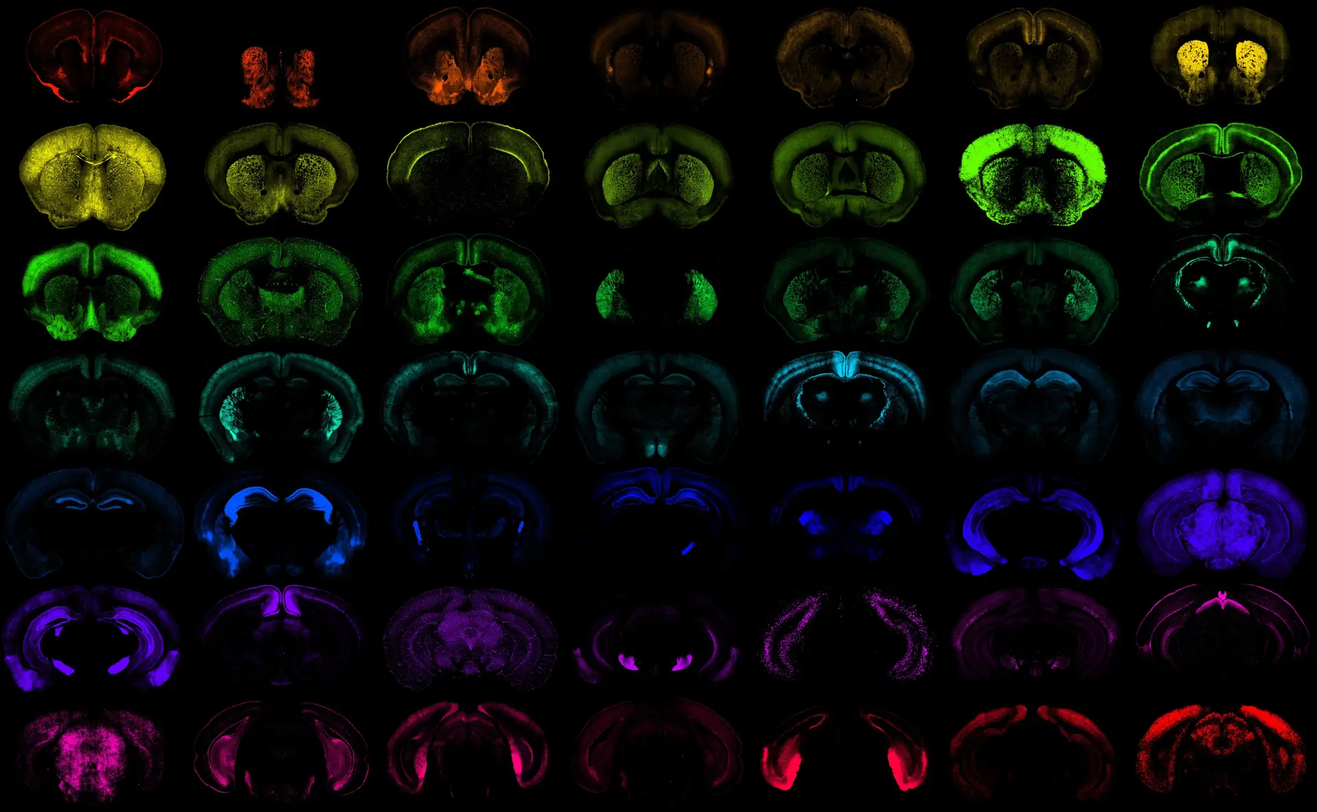 The mouse is one of the new genetic tools developed on the Alen Institute of different cell population in the brain.