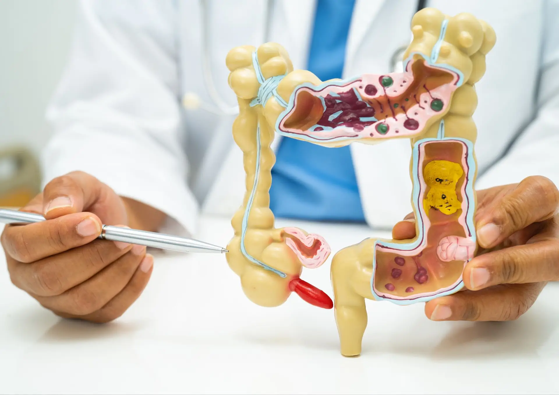 Diretor do programa de hepatites alerta: "Há três cancros do aparelho digestivo que vão aumentar"
