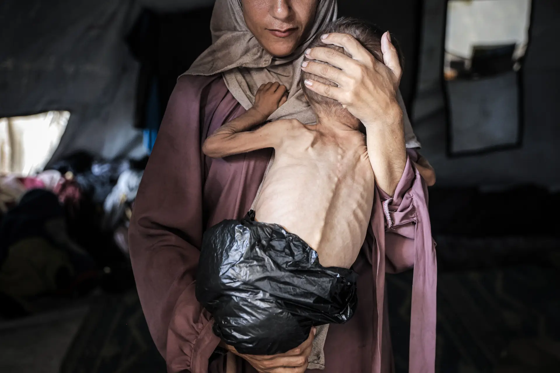 Clínicas de Gaza em silêncio porque "crianças não têm forças para falar ou chorar"