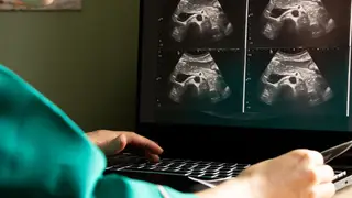 Nova descoberta promete simplificar deteção de cancro da bexiga avançado