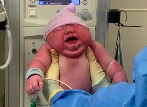 Recém-nascido com quase 6 quilos bate recorde hospitalar e torna-se viral nas redes sociais