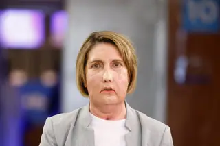 Hospital espanhol faz transplante de cara de doadora que pediu eutanásia pela primeira vez no mundo