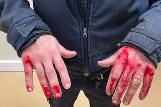 Agente da PSP arrastado por carro durante fiscalização no aeroporto do Porto