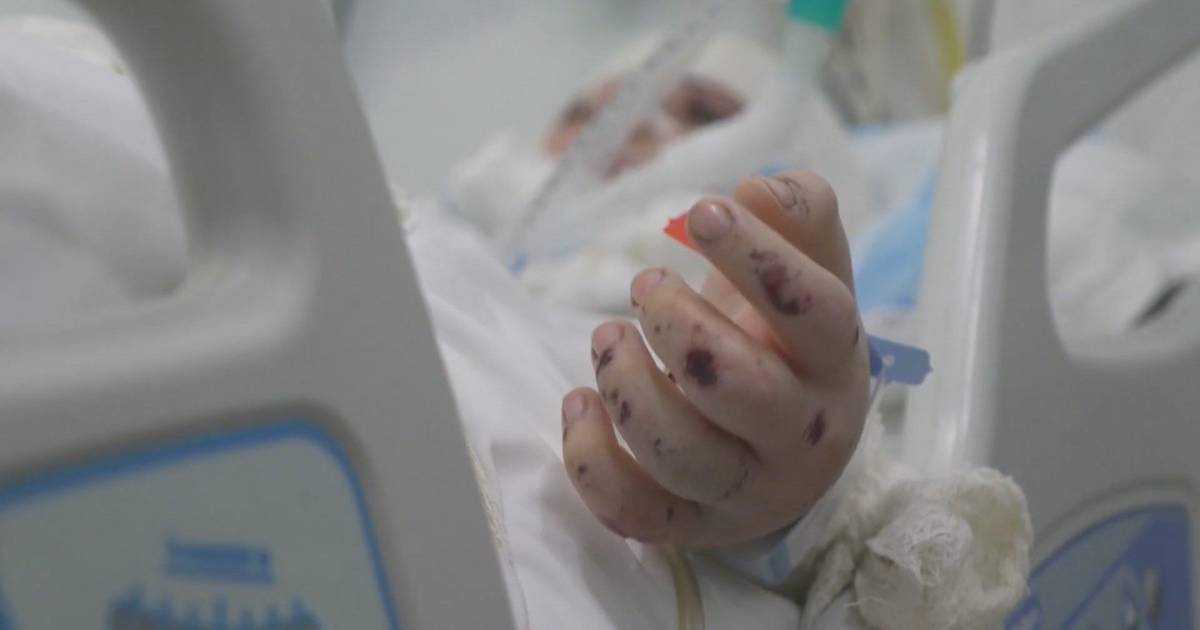 Ataques no Líbano fazem cerca de 20 crianças vítimas por dia: Zainab sobreviveu mas está em estado crítico após perder a família